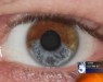 Разработана методика "перекрашивания" глаз лазером