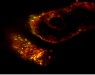 Ученым наконец удалось создать «обнуленные» стволовые клетки